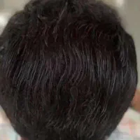 پرپــشتی مو