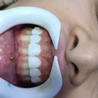 کامپوزیت زیبایی آف تابستونه