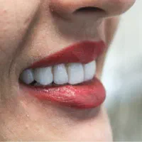 ایمپلنت تخصصی با شرایط ویژه