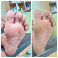 پدیکور خانم ها