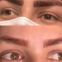 فیبروز ابرو  فقط  برای ۱۰ نفر اول فقط هزینه مواد