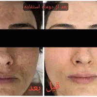 روشن کننده۱۰تا۲۰درجه۱گیاهی