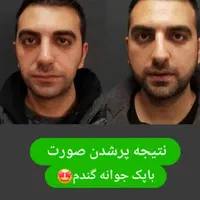 تپلی صورت|آرایشی، بهداشتی، درمانی|رشت, بلوار گیلان|دیوار
