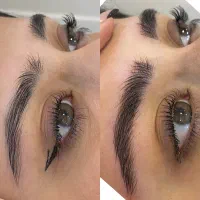 خدمات فیبروز و شیدینگ و خط چشم