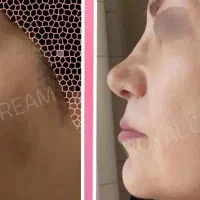 فروش کرم ضد لک ابرسان آلمانی تحت لیسانس آلمان