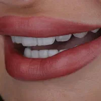 جراح دندانپزشک دکتر دانیال قشقایی|خدمات آرایشگری و زیبایی|کرمانشاه, |دیوار