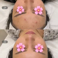 پذیرش مدل فیشیال باقیمت ویژه برای تکمیل نمونه کار