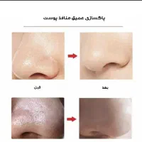 میکرودرم خانگی مدل 3w|آرایشی، بهداشتی، درمانی|تهران, سید خندان (جلفا)|دیوار