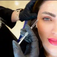 مدل ژل 570و بوتاکس550