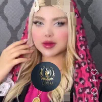 تزریق تخصصی ژل ومادلینگ خلیجی واروپایی وبوتاکس