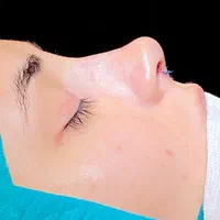عمل جراحی زیبایی بینی،لیفت صورت،گوش|خدمات آرایشگری و زیبایی|تهران, تهرانپارس غربی|دیوار