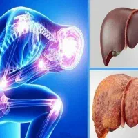 مشکل.گوارشی. کبد.چرب. چاقی