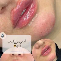 کلینیک زیبایی و لیزر آیسان فیلر و بوتاکس|خدمات آرایشگری و زیبایی|قم, دروازه چوبی|دیوار