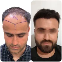 کاشتمو شیراز با شرایط اقساط