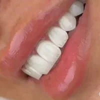 سلامت دندان مهمترین عنصر آراستگی صورت|خدمات آرایشگری و زیبایی|کرمان, |دیوار