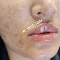 خدمات زیبایی پوست و مو با تخفیف ویژه|خدمات آرایشگری و زیبایی|قم, صفائیه|دیوار