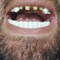 کلیه خدمات دندانپزشکی . زیبایی|خدمات آرایشگری و زیبایی|رشت, گلسار|دیوار