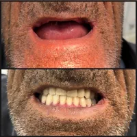 دندانپزشکی ودندان سازی مروارید۳۰٪ اف