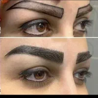 اقساطی کاشت مو تضمینی/کاشت ابرو کاشت|خدمات آرایشگری و زیبایی|تهران, چیذر|دیوار