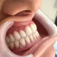 ساخت دندان مصنوعی با کم ترین قیمت|خدمات آرایشگری و زیبایی|تهران, جیحون|دیوار