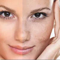 جشنواره مشاور رایگان زیبایی|خدمات آرایشگری و زیبایی|آمل, |دیوار