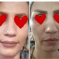 صورتت رو تاعید تپل کن وشاداب کن|آرایشی، بهداشتی، درمانی|میان جلگه, |دیوار