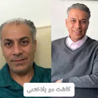 کاشت مو به صورت حرفه ای و با کیفیت عالی و تضمینی|خدمات آرایشگری و زیبایی|پارس‌آباد, |دیوار