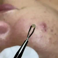 فیشیال تخصصی پوست به مدت محدود فقط۲۰۰تومن|خدمات آرایشگری و زیبایی|مشهد, طبرسی شمالی|دیوار