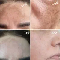 کرم تضمینی جواب نگرفتی پولتوپس بگیر|آرایشی، بهداشتی، درمانی|امیدیه, |دیوار