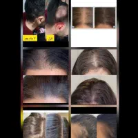 آموزش روغن درمانی ویژه|خدمات آموزشی|خاش, |دیوار