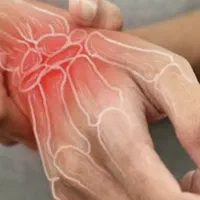 درمان دردهای رماتیسم و آرتروزمفصل|آرایشی، بهداشتی، درمانی|کرج, گوهردشت|دیوار
