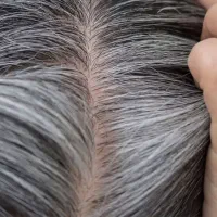 راهنمایی سفید شدن مو