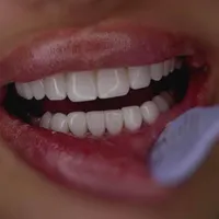 دندانپزشکی کامپوزیت لمینت ایمپلنت لیفت لثه بلچینگ|خدمات آرایشگری و زیبایی|مشهد, سجاد شهر|دیوار