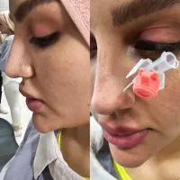 انجام خدمات زیبایی پرسینگ