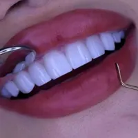دندانپزشکی بدون پیش پرداخت عصب کشی . کامپوزیت و...|خدمات آرایشگری و زیبایی|قم, عمار یاسر|دیوار