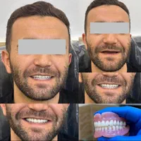 دندان مصنوعی لبخند (ضمانت ۱۰ ساله/تحویل ۳تا ۷ روز)|خدمات آرایشگری و زیبایی|کرج, اصفهانیها|دیوار