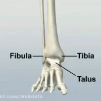 شکسته بند.دررفتگی. حجامت فصدناف زالو خانم و آقا