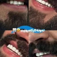 لبخند شما افتخار ماست|خدمات آرایشگری و زیبایی|اصفهان, باتون|دیوار