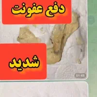 بهبودوپاکسازی رحم،کیست وفیبروم،تنبلی تخمدان،عفونت|خدمات آرایشگری و زیبایی|کلاله, |دیوار