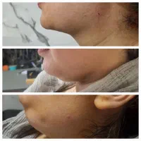 خدمات زیبایی پزشکی تزریق ژل و بوتاکس وچربی|خدمات آرایشگری و زیبایی|اهواز, کیانپارس |دیوار