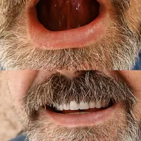 دندانسازی پیرهادی