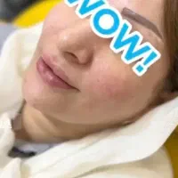 خدمات ژل و بوتاکس هر سی سی ژل ۴۸۰|خدمات آرایشگری و زیبایی|اهواز, حصیرآباد|دیوار