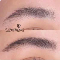 مدل میکرو بلیدینگ فیبروز رایگان