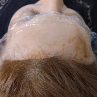 خدمات اسکالپ سر|خدمات آرایشگری و زیبایی|اصفهان, عسگریه|دیوار