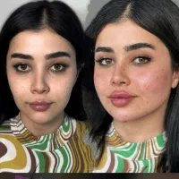 جشنواره استثنایی زیبایی کلینیک بهشت