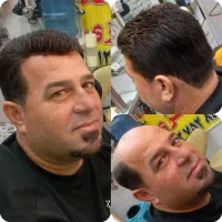 پیرایش و ترمیم موی مرکزی