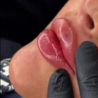 مدل جهت تزریق ژل