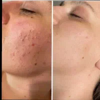 کرم وی ای پی اصل صدرصد تضمینی و بدون بازگشت|آرایشی، بهداشتی، درمانی|یاسوج, |دیوار