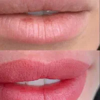 تتو ،میکرو،فیبروز ،شیدینگ