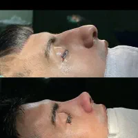 جراحی بینی فقط با ۳۰میلیون کلینیک تخصصی